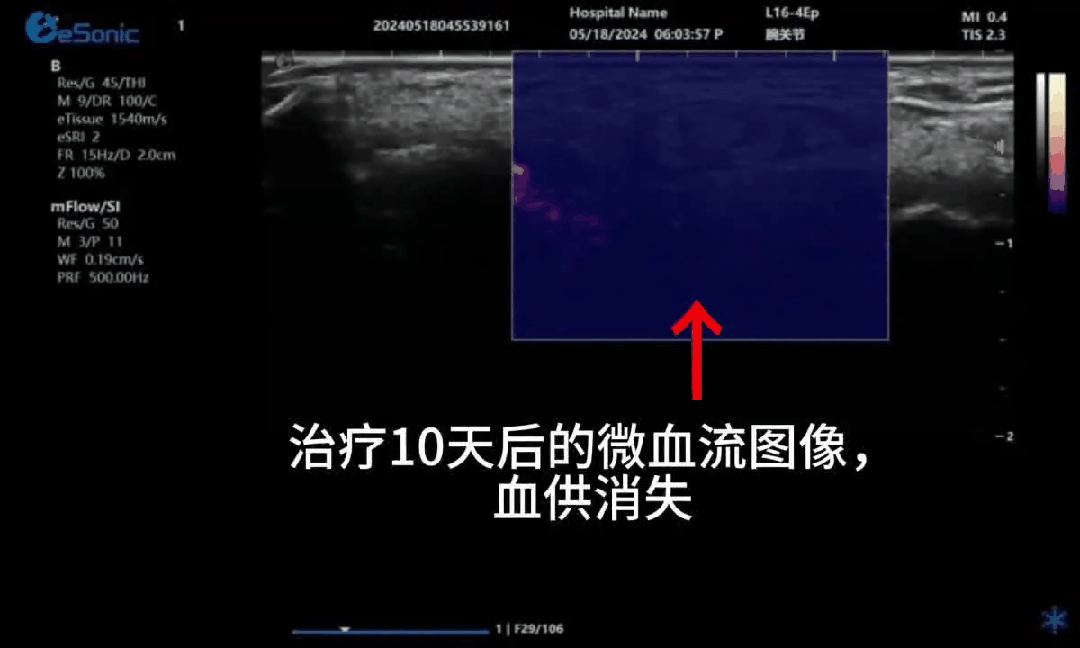 07.gif
